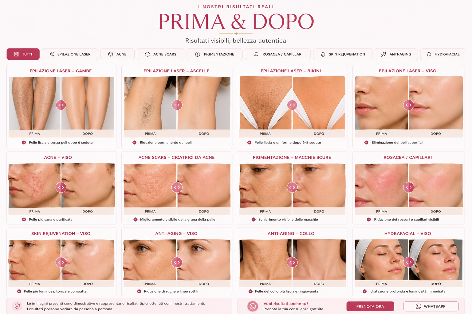 Galleria illustrativa Prima e Dopo dei trattamenti Nina Glow Beauty Skin
